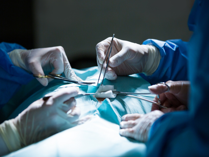 Coronary Artery Bypass Surgery (CABG)